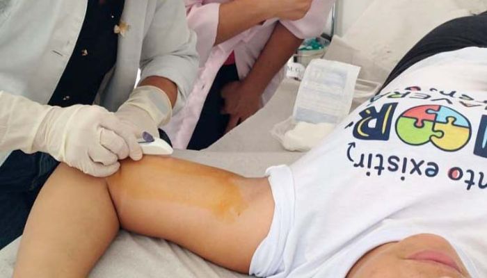 Com 5,9 mil inserções em 2026, Estado intensifica treinamento para implante contraceptivo